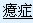 又称歇斯底里，是由明显的心因性刺激因素作用于易感个体而引发的一组精神症状。。表现为不能为主观意志所控制的反复出现的一些观念、意向和行为。强迫症的特点是有意识的自我强迫和自我反强迫同时存在，两者的尖锐冲突使患者焦虑和痛苦。